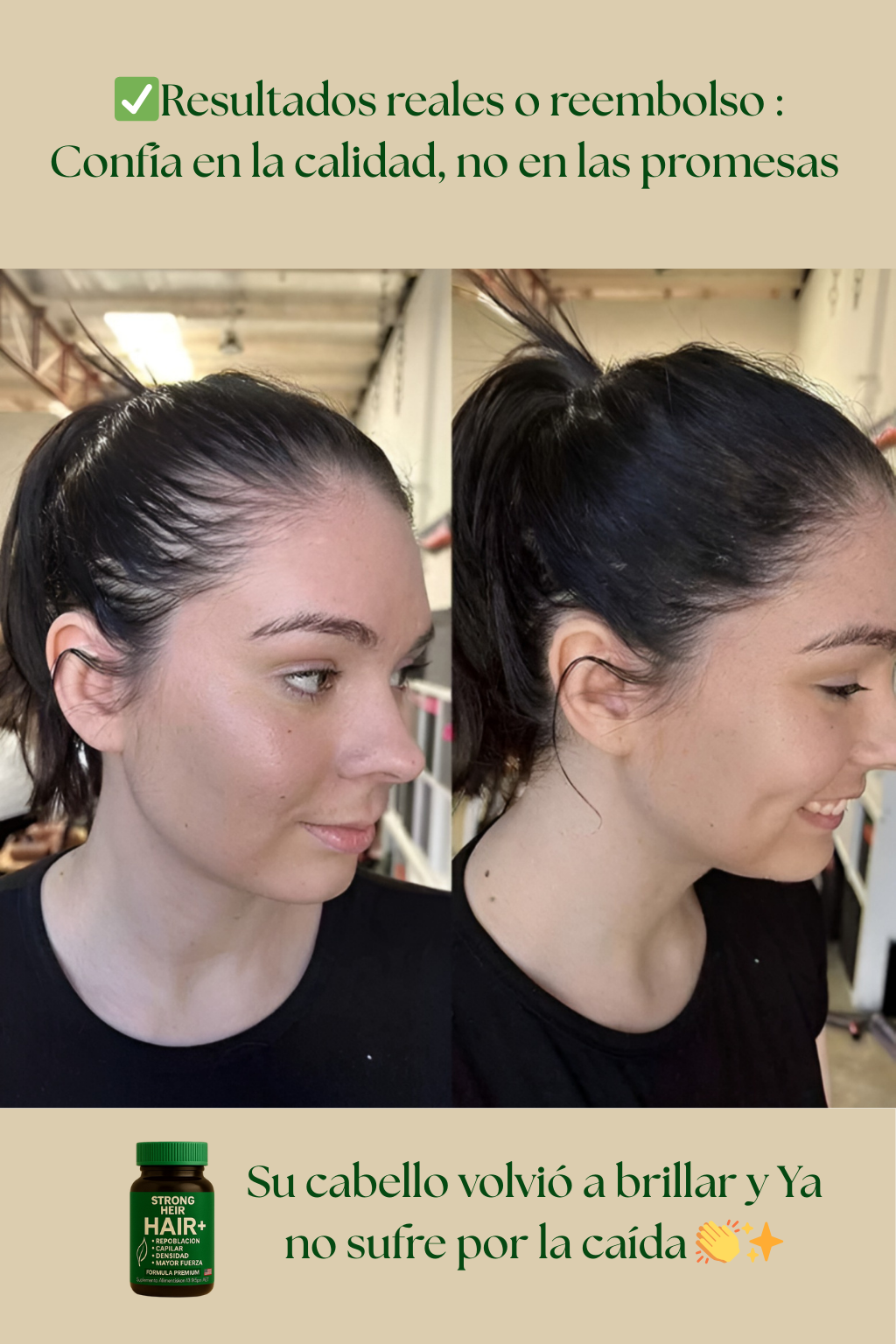 Cápsulas de Biotina Premium: Nutrición Total para tu Cabello y Uñas
