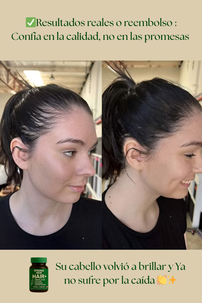 Cápsulas de Biotina Premium: Nutrición Total para tu Cabello y Uñas